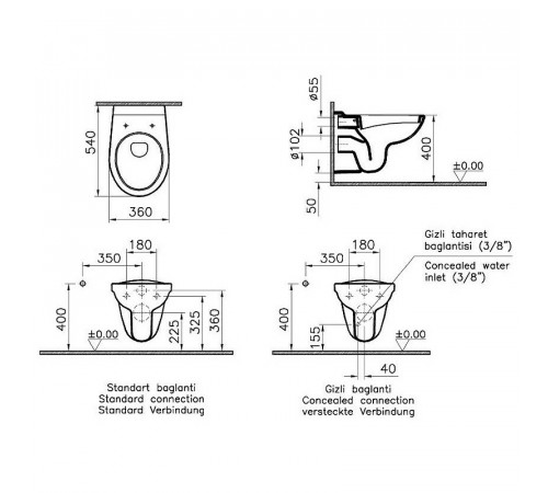 Комплект унитаза с инсталляцией Vitra Normus 9773B003-7203 с сиденьем Микролифт и клавишей смыва Хром матовый