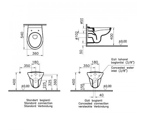 Комплект унитаза с инсталляцией Vitra Normus L-box 9773B003-7206 с сиденьем Микролифт и клавишей смыва Хром глянцевый